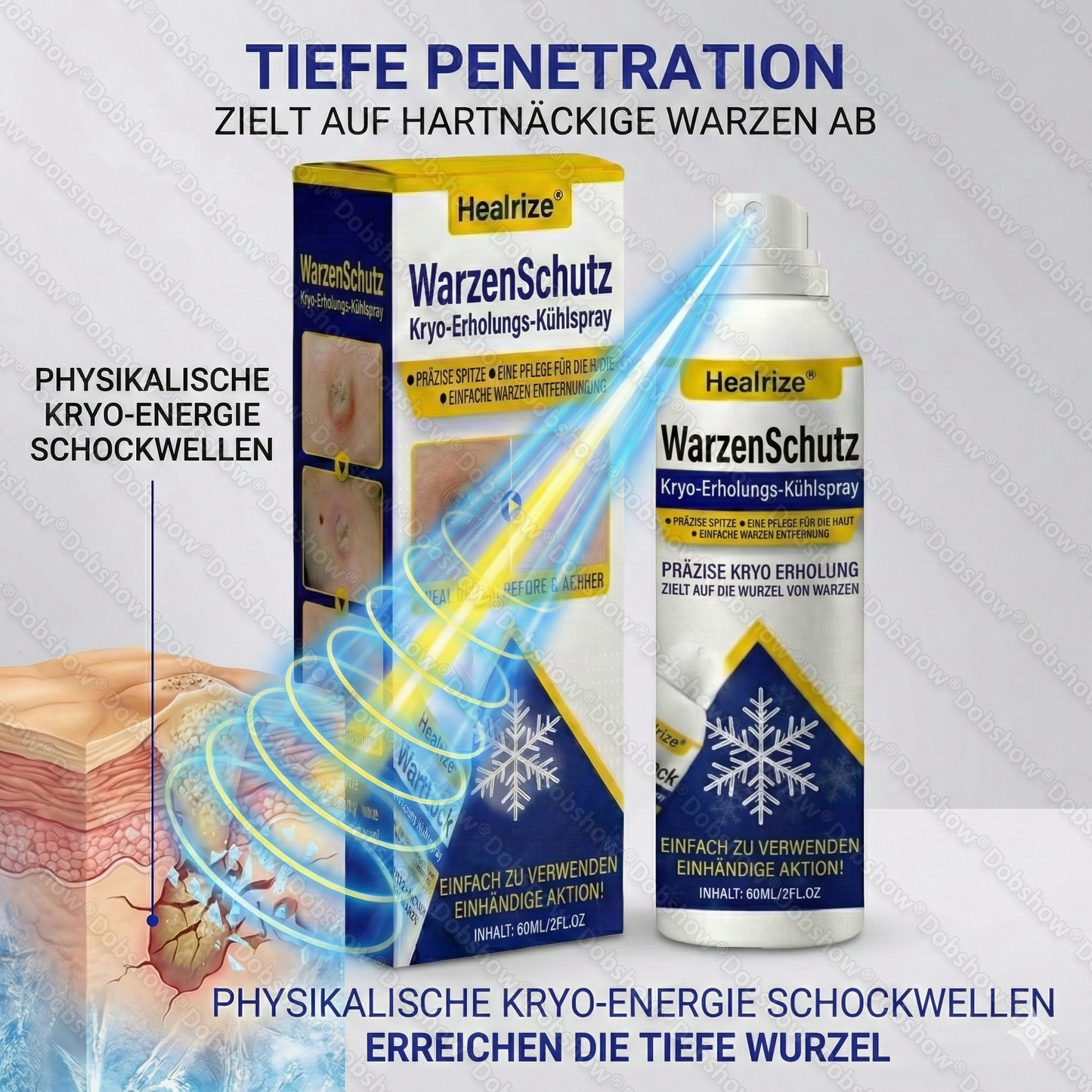 ❄️Bestseller❄️ Healrize® WartLock Kryo-Recovery Kühlspray🎉 Zeitlich begrenzter Sonderrabatt（