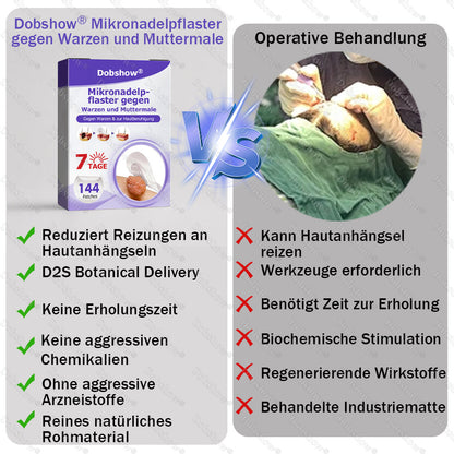 ⭐Dobshow® Mikronadelpflaster gegen Warzen und Muttermale -z