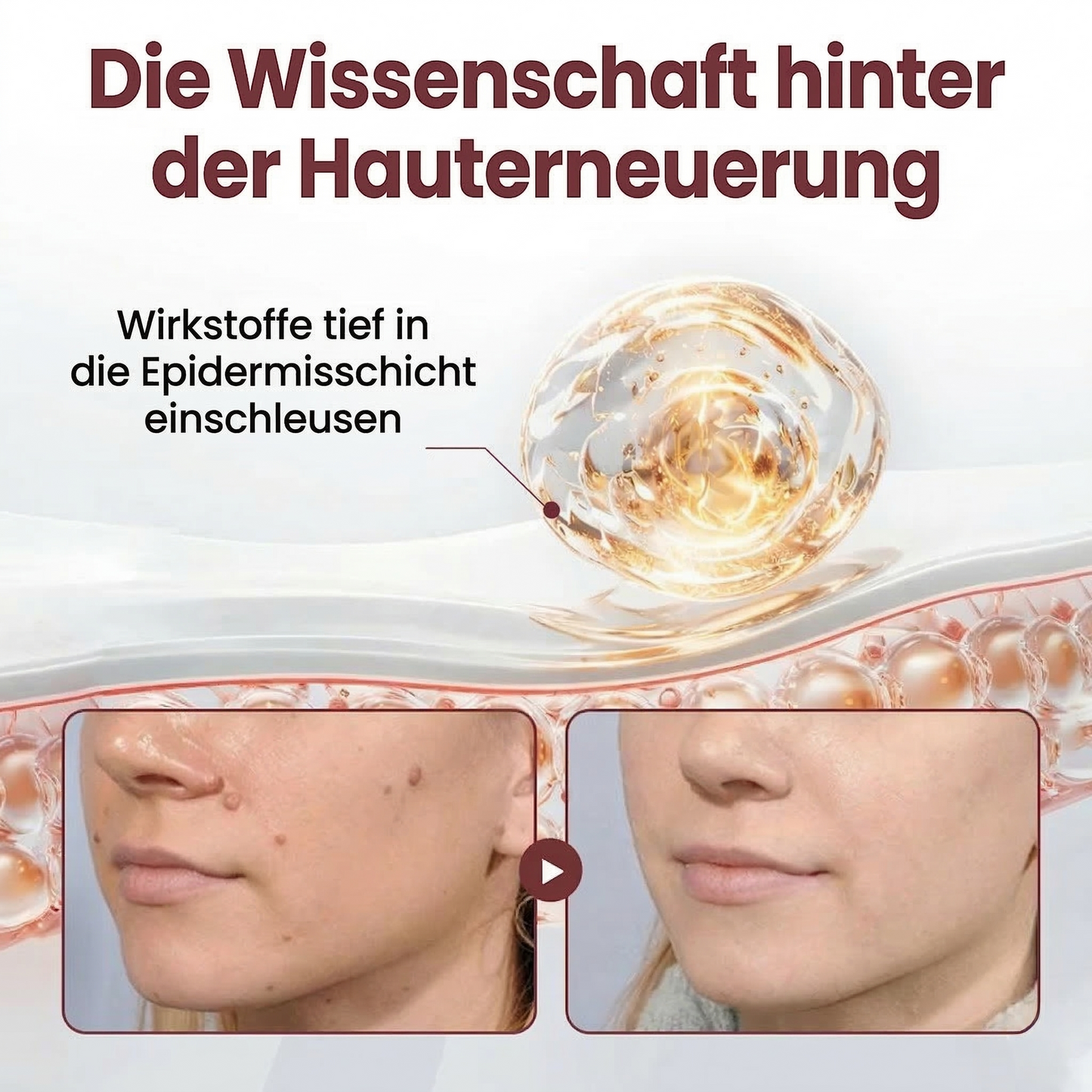 🍃Healrize®🎉Schwarzer Reis Dual-Wirkung Korrekturcreme für Warzen-