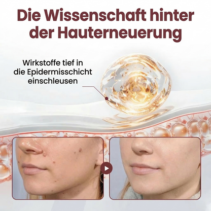 🍃Healrize®🎉Schwarzer Reis Dual-Wirkung Korrekturcreme für Warzen-