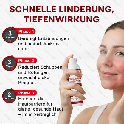🌟Bestseller |🐌Healrize® Schneckenmucin-Barriere-Spray zur Linderung von Hautschüben und zur Regeneration der Haut-𝘿𝙚𝙪𝙩𝙨𝙘𝙝𝙡𝙖𝙣𝙙𝙨 𝙉𝙧. 1 𝙨𝙥𝙧ü𝙝𝙗𝙖𝙧𝙚 𝘽𝙖𝙧𝙧𝙞𝙚𝙧𝙚-𝙋𝙛𝙡𝙚𝙜𝙚 𝙗𝙚𝙞 𝙋𝙨𝙤𝙧𝙞𝙖𝙨𝙞𝙨