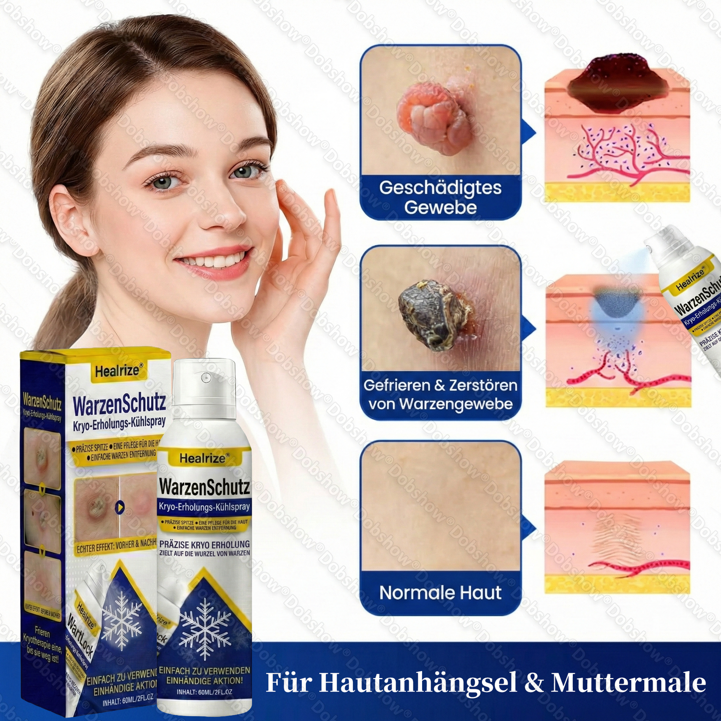 ❄️Bestseller❄️ Healrize® WartLock Kryo-Recovery Kühlspray🎉 Zeitlich begrenzter Sonderrabatt（