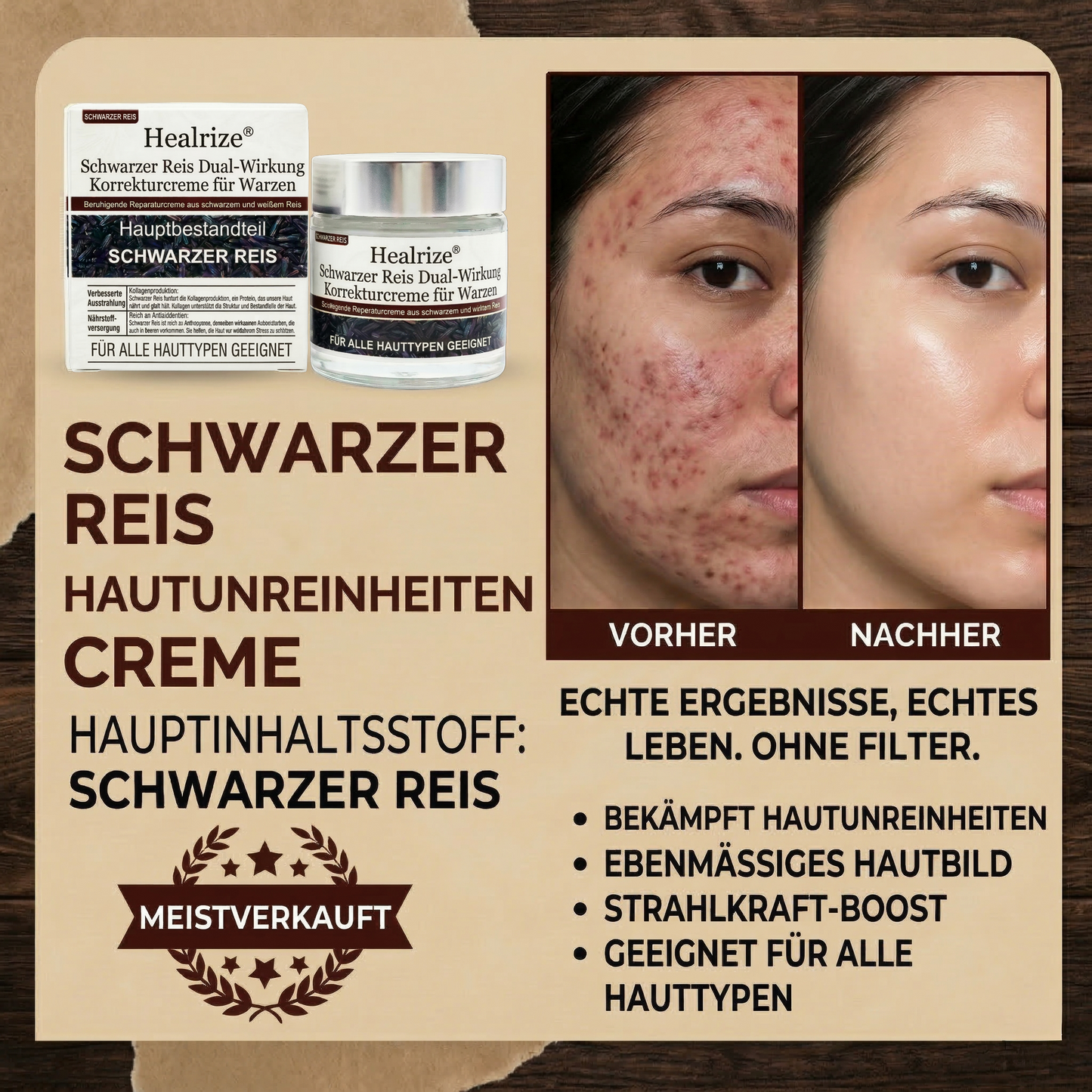 🍃Healrize®🎉Schwarzer Reis Dual-Wirkung Korrekturcreme für Warzen-