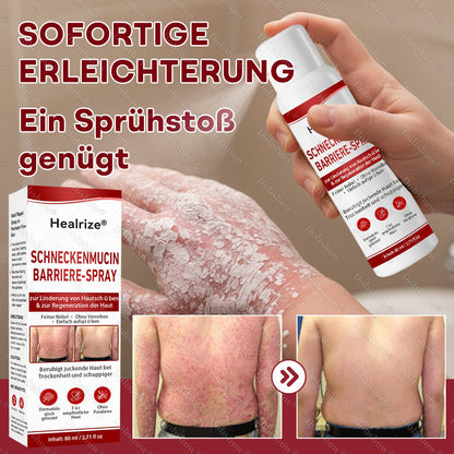 🌟Bestseller |🐌Healrize® Schneckenmucin-Barriere-Spray zur Linderung von Hautschüben und zur Regeneration der Haut-𝘿𝙚𝙪𝙩𝙨𝙘𝙝𝙡𝙖𝙣𝙙𝙨 𝙉𝙧. 1 𝙨𝙥𝙧ü𝙝𝙗𝙖𝙧𝙚 𝘽𝙖𝙧𝙧𝙞𝙚𝙧𝙚-𝙋𝙛𝙡𝙚𝙜𝙚 𝙗𝙚𝙞 𝙋𝙨𝙤𝙧𝙞𝙖𝙨𝙞𝙨