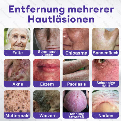 ⭐Dobshow® Mikronadelpflaster gegen Warzen und Muttermale -z