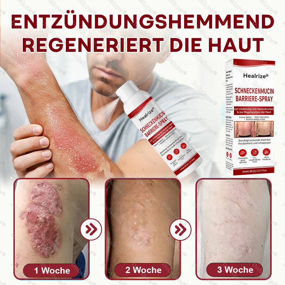 🌟Bestseller |🐌Healrize® Schneckenmucin-Barriere-Spray zur Linderung von Hautschüben und zur Regeneration der Haut-𝘿𝙚𝙪𝙩𝙨𝙘𝙝𝙡𝙖𝙣𝙙𝙨 𝙉𝙧. 1 𝙨𝙥𝙧ü𝙝𝙗𝙖𝙧𝙚 𝘽𝙖𝙧𝙧𝙞𝙚𝙧𝙚-𝙋𝙛𝙡𝙚𝙜𝙚 𝙗𝙚𝙞 𝙋𝙨𝙤𝙧𝙞𝙖𝙨𝙞𝙨
