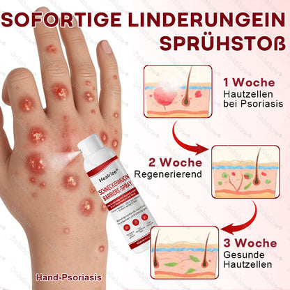 🌟Bestseller |🐌Healrize® Schneckenmucin-Barriere-Spray zur Linderung von Hautschüben und zur Regeneration der Haut-𝘿𝙚𝙪𝙩𝙨𝙘𝙝𝙡𝙖𝙣𝙙𝙨 𝙉𝙧. 1 𝙨𝙥𝙧ü𝙝𝙗𝙖𝙧𝙚 𝘽𝙖𝙧𝙧𝙞𝙚𝙧𝙚-𝙋𝙛𝙡𝙚𝙜𝙚 𝙗𝙚𝙞 𝙋𝙨𝙤𝙧𝙞𝙖𝙨𝙞𝙨