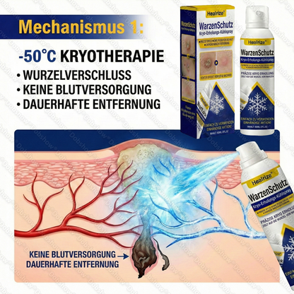 ❄️Bestseller❄️ Healrize® WartLock Kryo-Recovery Kühlspray🎉 Zeitlich begrenzter Sonderrabatt（